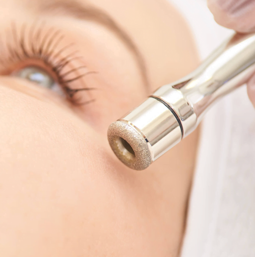 Microdermabrasion feinschliff-aesthetik Microdermabrasion feinschliff-aesthetik